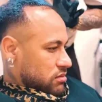 Dr. Vlassios Marangos alerta sobre calvície após fala de Piovani sobre Neymar