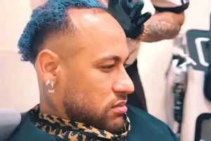 Dr. Vlassios Marangos alerta sobre calvície após fala de Piovani sobre Neymar